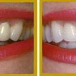 Rembrandt whitening toothpaste