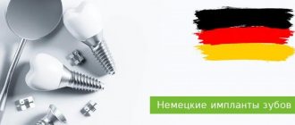 dental implants from Germany