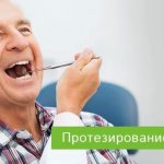 Зубы верхней челюсти